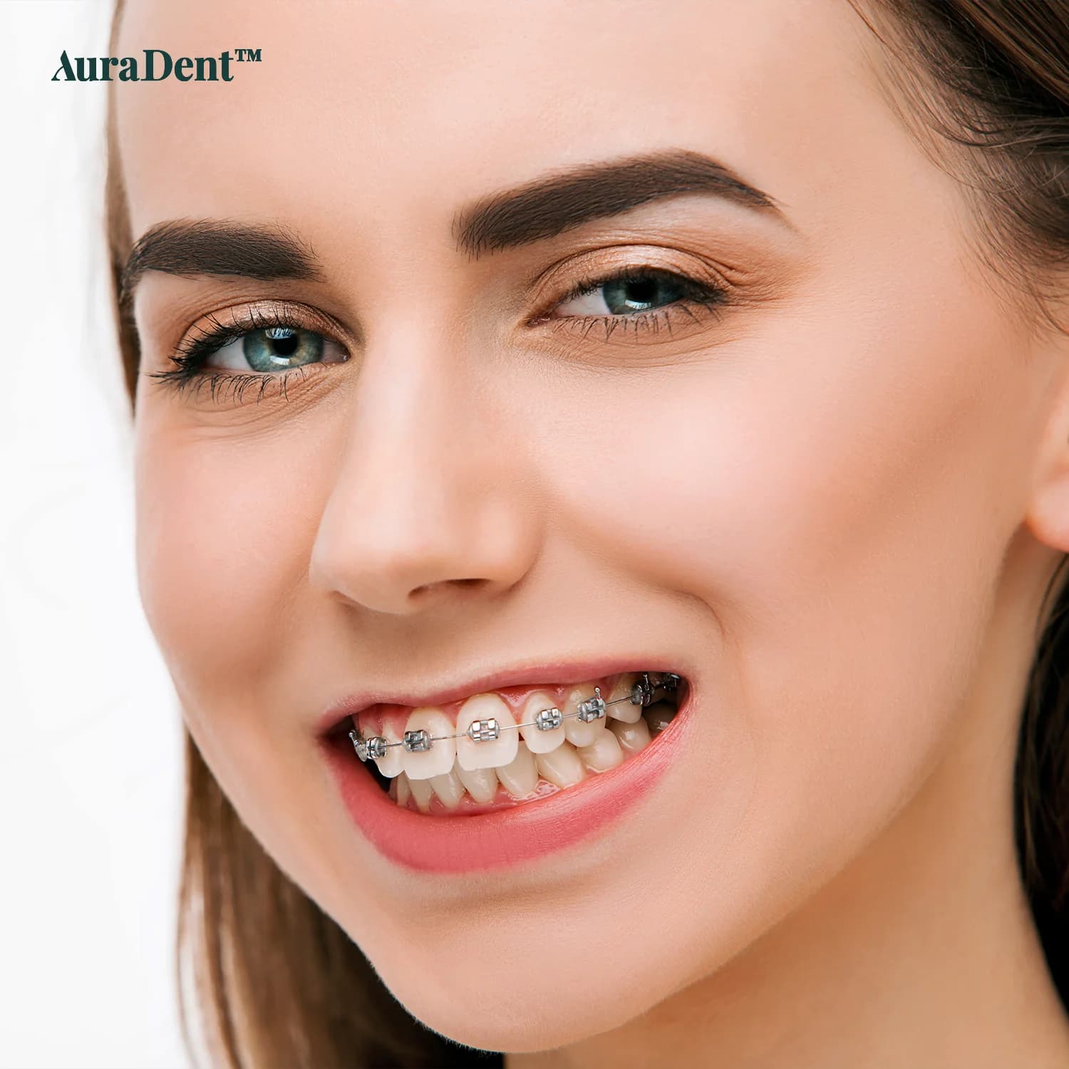 Hur mycket överbett kräver tandställning: en professionell vägledning