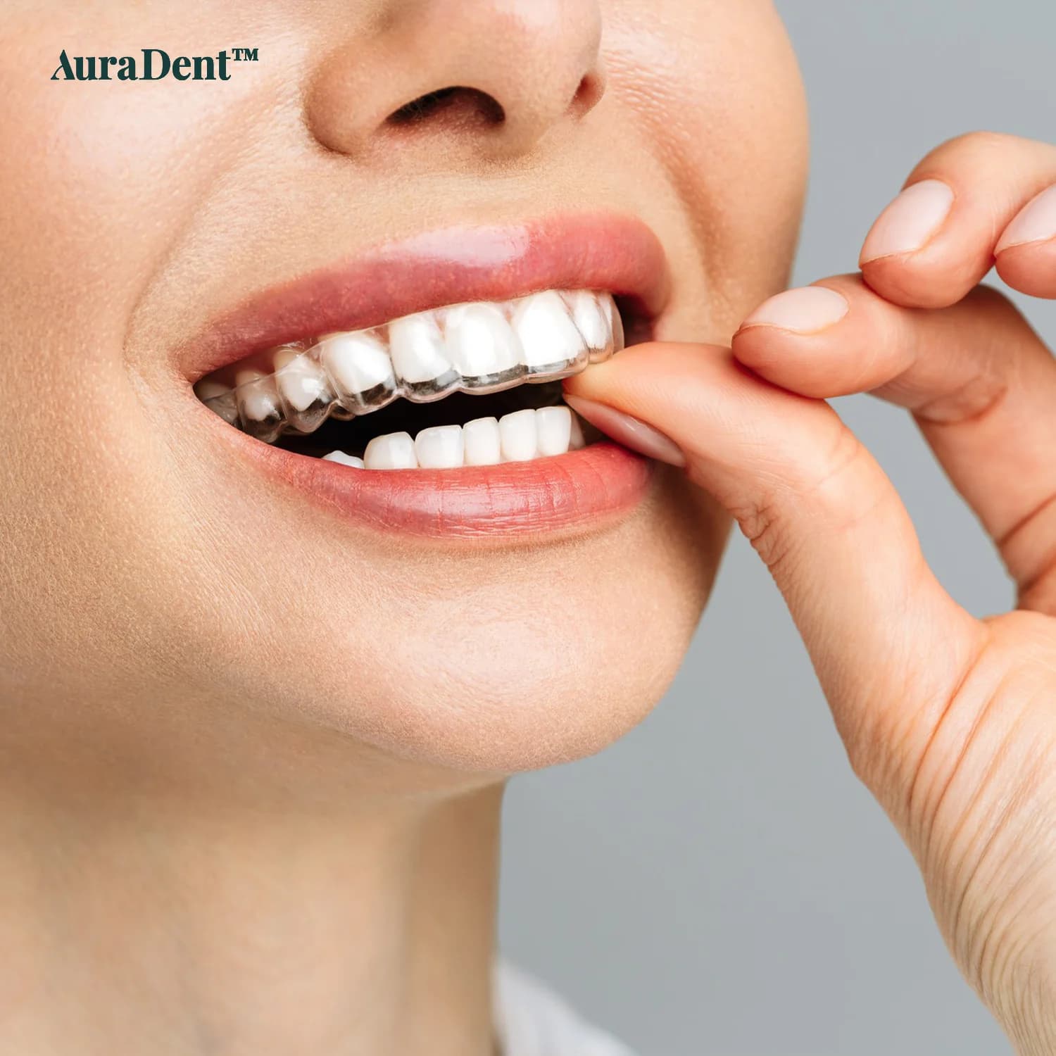 Vilken tandställning passar dig? Olika typer av tandställningar förklarade